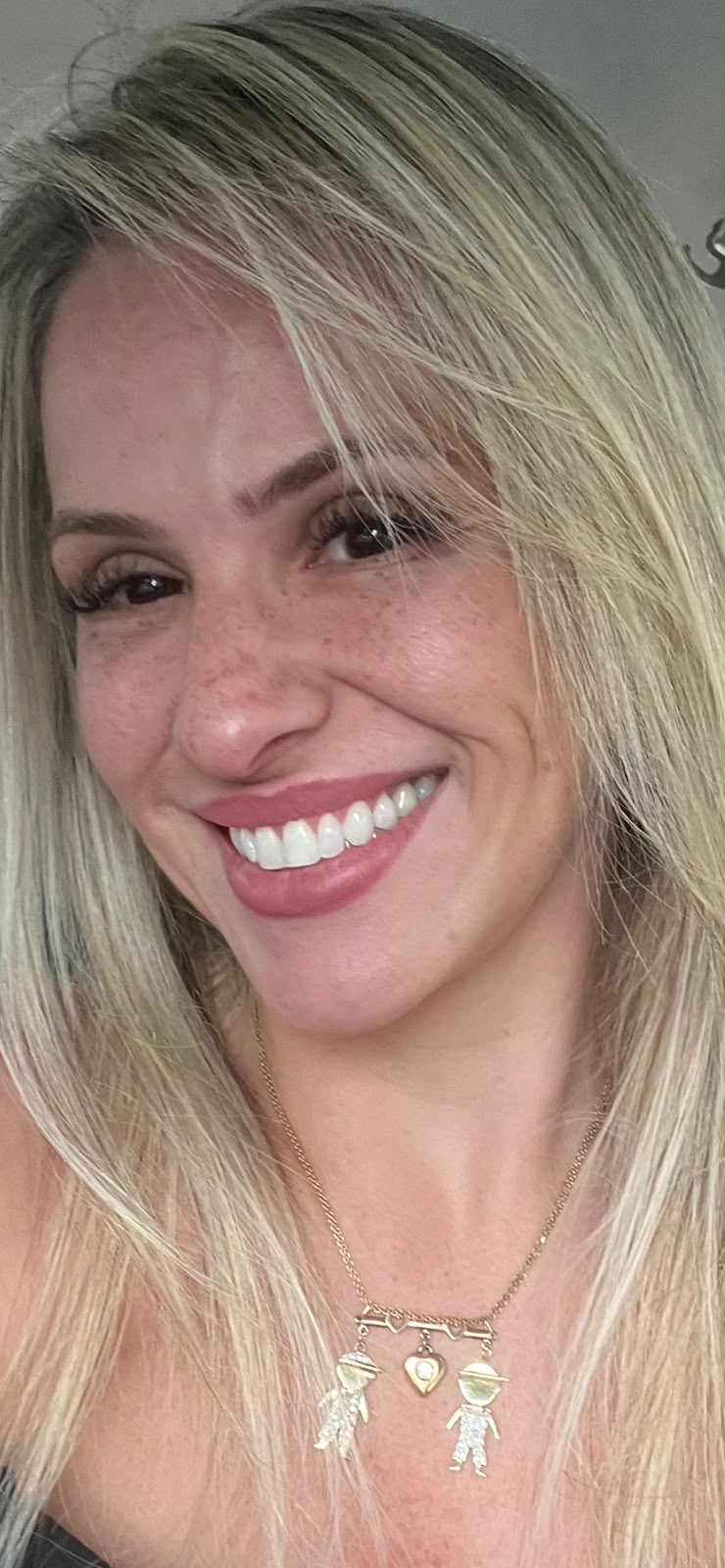 Detalhe de sorriso finalizado